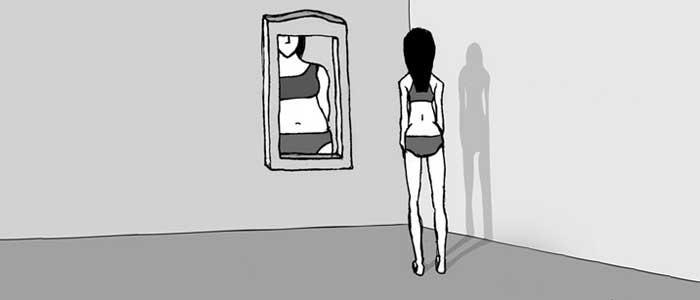 anorexia